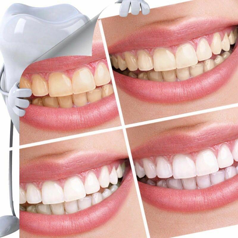 Teeth whitening tool Teeth whitening tool Personal Care Teeth whitening tool Teeth whitening tool Personal Care