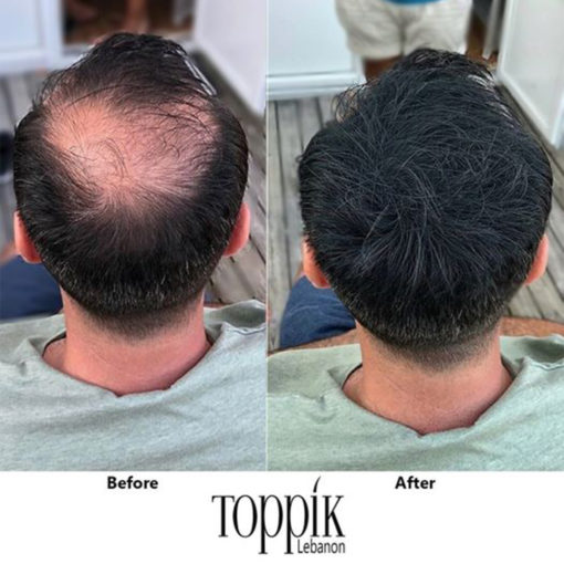 مجموعة العناية بالشعر (Toppik Hair Fibers لفراغات الشعر+Enliven لتثبيت الشعر ) مجموعة العناية بالشعر (Toppik Hair Fibers لفراغات الشعر+Enliven لتثبيت الشعر ) العناية الشخصية